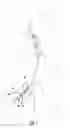 Fig. 02 - COMBINED VASCULAR AND CLOSURE SHEATH