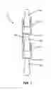 Fig. 02 - Multi-level interspinous implants and methods of use