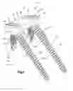 Fig. 09 - Anchor-in-anchor system for use in bone fixation