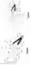 Fig. 49 - Anchor-in-anchor system for use in bone fixation