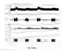 Fig. 17 - Brown adipose tissue utilization through neuromodulation