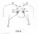 Fig. 09 - CARDIOVERSION ELECTRODE