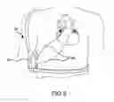 Fig. 15 - CARDIOVERSION ELECTRODE
