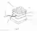 Fig. 02 - ELECTROTHERAPY APPARATUS