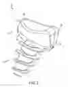Fig. 03 - Articular Surface Implant