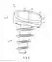 Fig. 05 - Articular Surface Implant