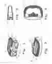Fig. 02 - Intervertebral fusion implant