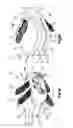 Fig. 02 - Low profile intervertebral implant