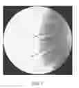 Fig. 08 - Polyaryletherketone artificial intervertebral disc