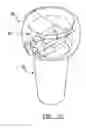 Fig. 05 - MODULAR PROSTHESIS AND USE THEREOF FOR REPLACING A RADIAL HEAD