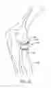 Fig. 07 - MODULAR PROSTHESIS AND USE THEREOF FOR REPLACING A RADIAL HEAD