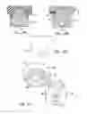 Fig. 10 - MODULAR PROSTHESIS AND USE THEREOF FOR REPLACING A RADIAL HEAD