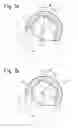 Fig. 02 - Method for implantation of a femoral implant