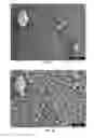 Fig. 04 - Bone graft material and uses thereof