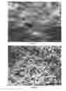 Fig. 07 - Bone graft material and uses thereof