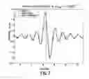 Fig. 07 - Moveout correction of seismic data