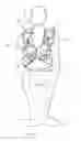 Fig. 09 - X-shaped utility garment
