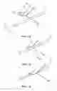 Fig. 02 - System for cutting a suture to create tissue retainers of a desired shape and size