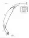 Fig. 02 - Self-sizing adjustable endotracheal tube