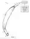 Fig. 02 - Self-sizing adjustable endotracheal tube