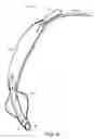 Fig. 06 - Self-sizing adjustable endotracheal tube