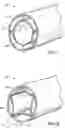 Fig. 07 - Self-sizing adjustable endotracheal tube