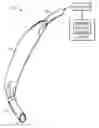 Fig. 01 - Self-sizing adjustable endotracheal tube