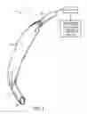 Fig. 02 - Self-sizing adjustable endotracheal tube