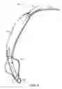 Fig. 06 - Self-sizing adjustable endotracheal tube