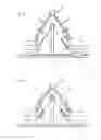 Fig. 04 - Method for reinforcing a fibre composite component and a vacuum mat and arrangement for producing a reinforced fibre composite component