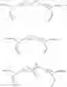 Fig. 02 - Swellable polymer with cationic sites