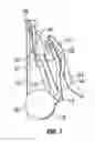 Fig. 08 - Pushchair frame