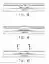 Fig. 03 - Patterning a thick film paste in surface features