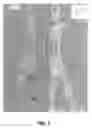 Fig. 09 - INTEGRATED MOTION CAPTURE