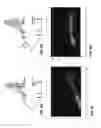 Fig. 08 - Method and system of adjusting a field of view of an interferometric imaging device