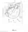 Fig. 07 - Hearing aid