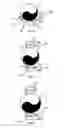 Fig. 07 - Method for laying pipeline using motorized elements