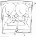 Fig. 01 - Inflatable cargo cushion