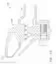 Fig. 09 - Mechanical joint for a gas turbine engine