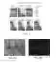 Fig. 08 - Conditionally Replicating Viruses for Cancer Therapy