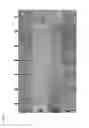 Fig. 02 - Primed cell therapy