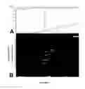 Fig. 05 - FEEDER CELL-FREE CULTURE MEDIUM AND SYSTEM