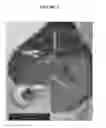 Fig. 08 - COMPOSITIONS AND METHODS FOR URINARY BLADDER REGENERATION