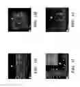 Fig. 05 - AGENTS AND METHODS FOR TREATING RESPIRATORY DISORDERS