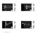 Fig. 07 - AGENTS AND METHODS FOR TREATING RESPIRATORY DISORDERS