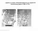 Fig. 01 - Compositions and methods for diagnosing and treating cancer