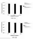 Fig. 02 - Bevacizumab formulations with lower aggregation propensity, comprising corticosteroid anti-inflammatory drugs