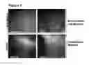 Fig. 02 - Culturing embryonic stem cells, embryonic stem-like cells, or induced pluripotent stem cells with a Muc1 or Muc1* ligand