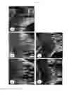 Fig. 02 - COMPOSITION COMPRISING THE EXTRACT OF CRUDE DRUG COMPLEX FOR STIMULATING BONE GROWTH