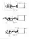 Fig. 02 - Apparatuses and methods for mandibular protrusion